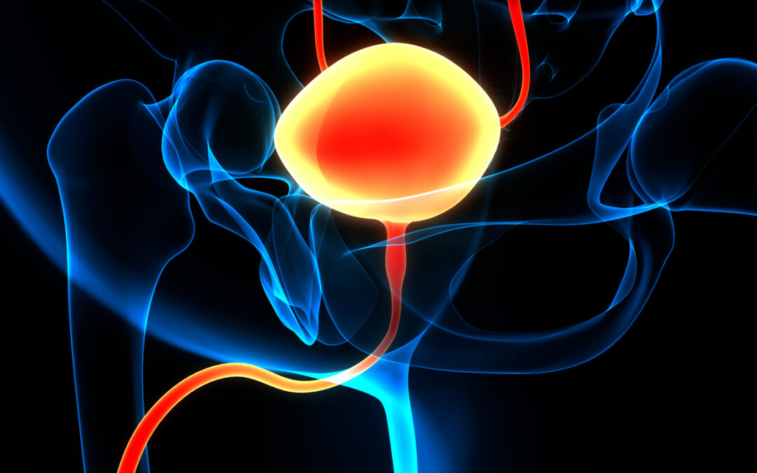 Voided Urine Cytology for Predicting Bladder Cancer Risk