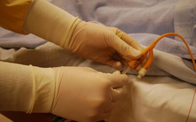 Bladder Cancer Risk and Urinary Catheters, Chronic UTIs, and Inflammation