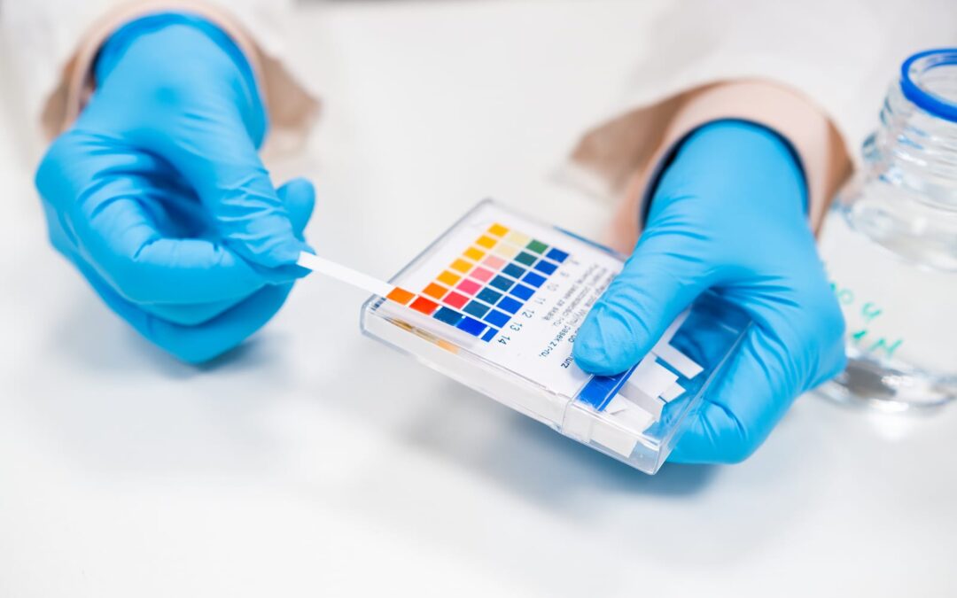 Urine Acidity as a Potential Biomarker for Treatment Outcomes in Non-Muscle-Invasive Bladder Cancer (NMIBC)